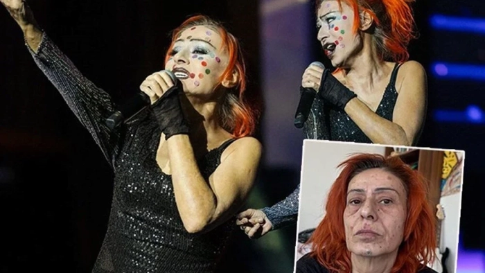 Yıldız Tilbe yüzündeki renkli beneklerle konser verdi